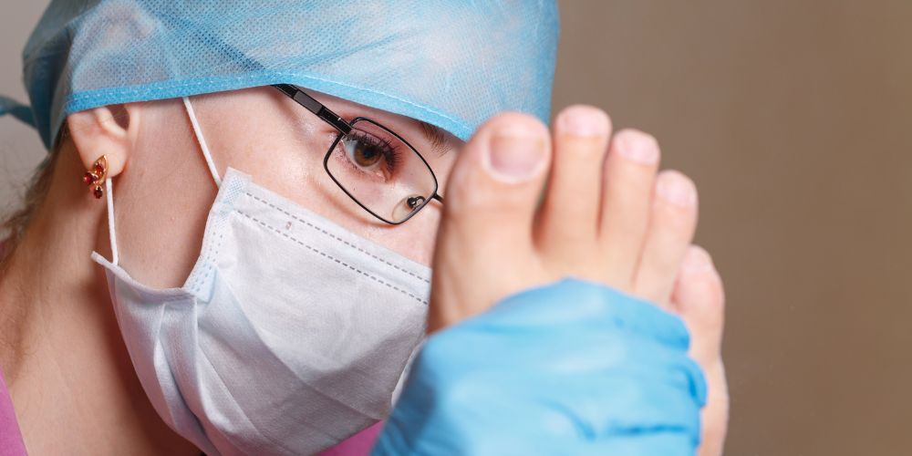 Professional Callus Removal