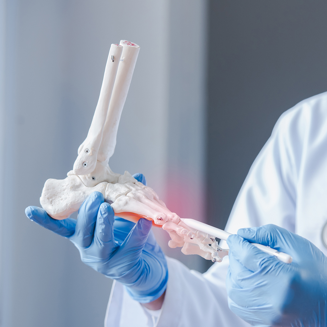 An orthopedic doctor looking at a fake ankle bone Male doctors orthopedic wears medical masks and medical gloves To analyze the causes of ankle degeneration in the office at the hospital