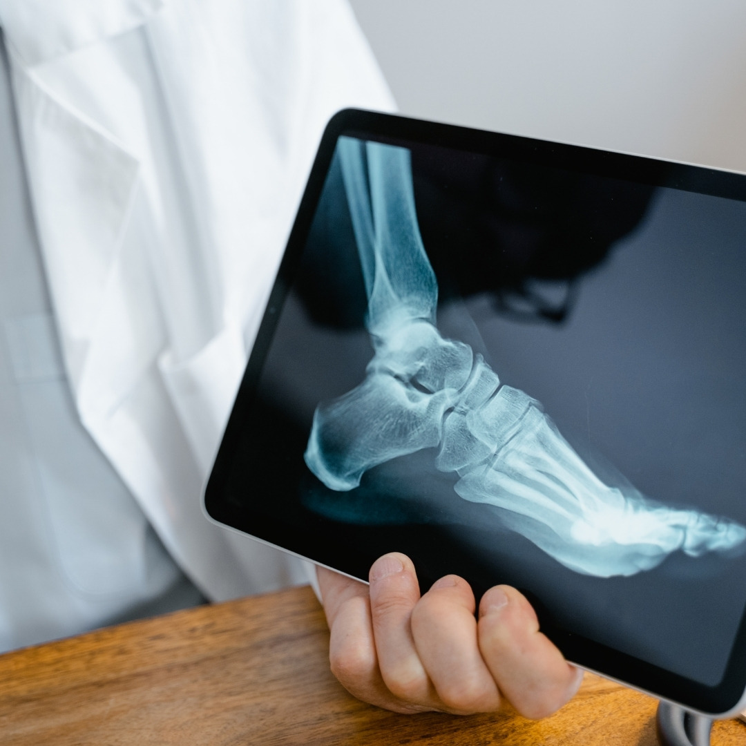 Reasons To Get Foot Or Ankle Surgery - Image 4