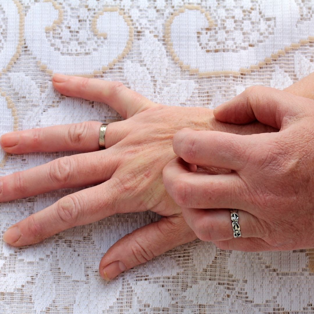 a person itching their hand